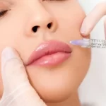 Mão segurando uma seringa com agulha, sendo preparada para aplicação. A imagem reflete um procedimento médico comum, possivelmente relacionado a vacinação ou administração de medicamentos, com destaque para a seringa em ambiente limpo e clínico.