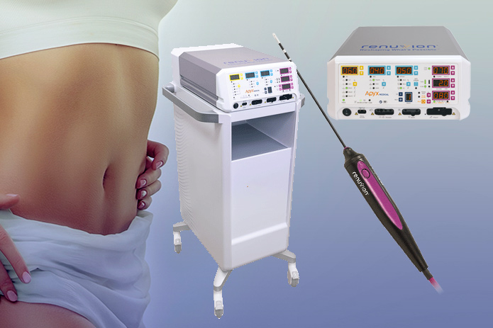 Equipamento Renuvion com ponteira cirúrgica ao lado do corpo feminino com abdômen definido, ilustrando tecnologia de radiofrequência com plasma usada para retração de pele e contorno corporal.